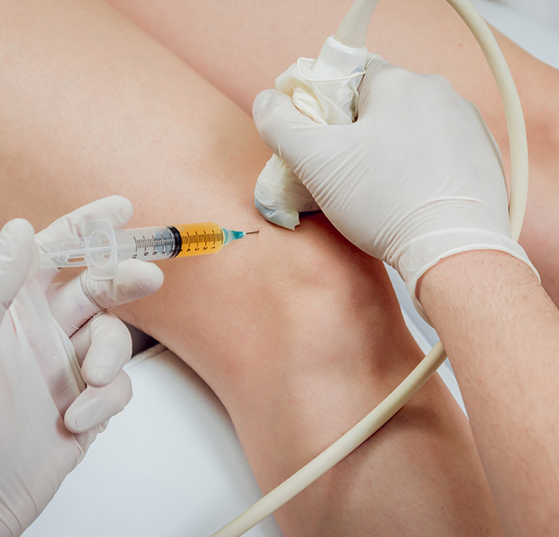 ultrasound-guided prp injections